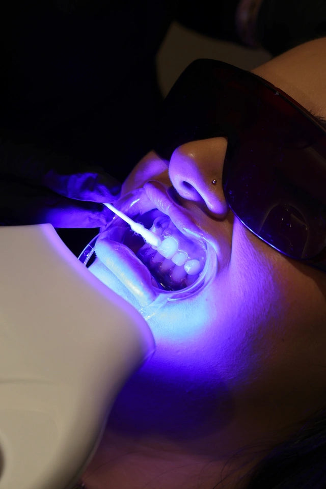 Professional Cosmetic Teeth Whitening Starter Training Kit