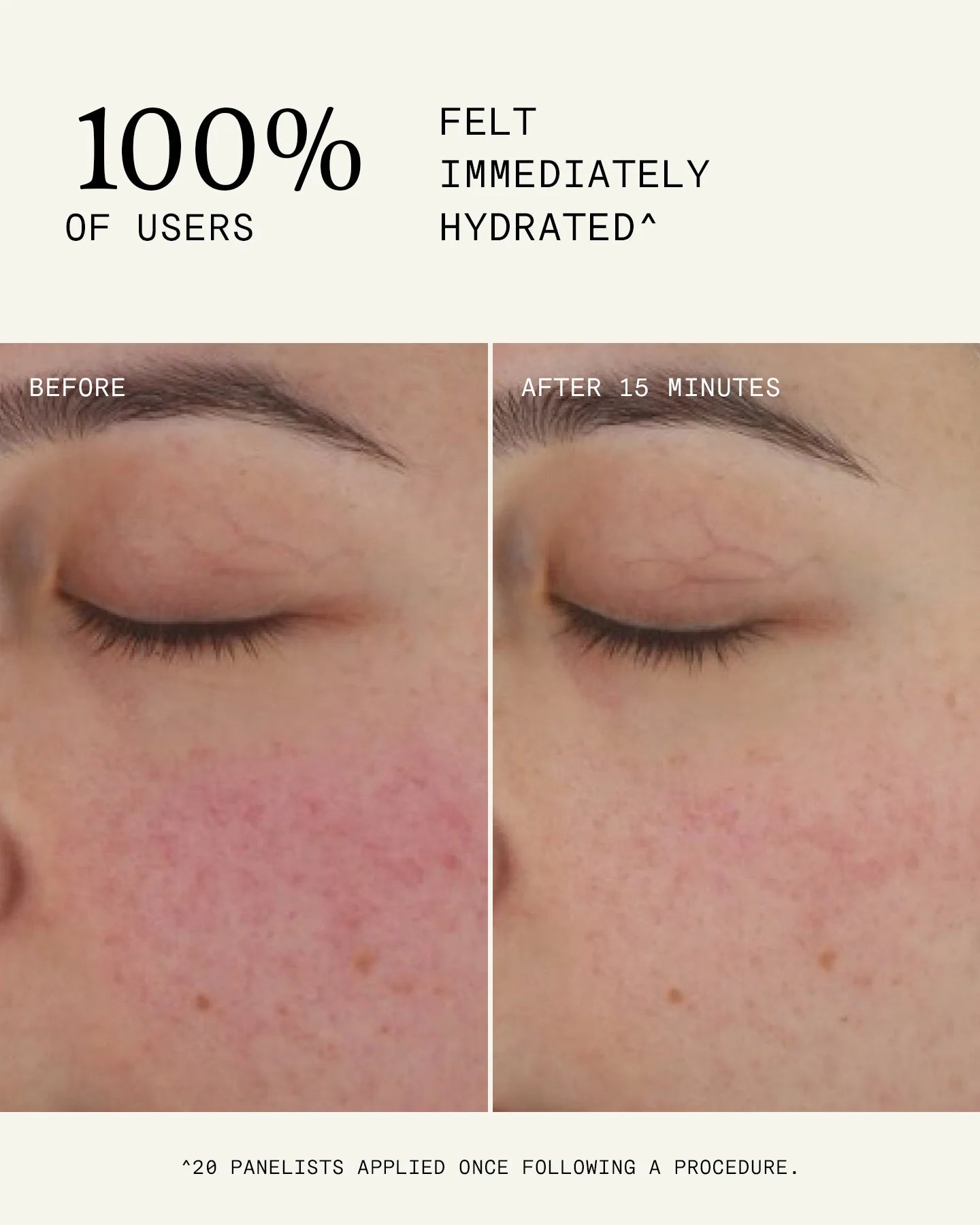 Ultra B² Recovery Cream